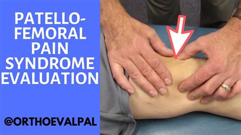 patellofemoral compression test|patellofemoral pain syndrome physical exam.